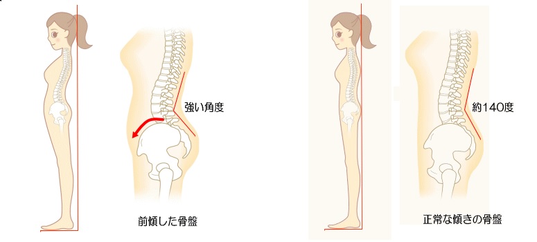 骨盤 痛い の 左 が 左の、付け根付近から下腹部や骨盤周辺の痛みについて
